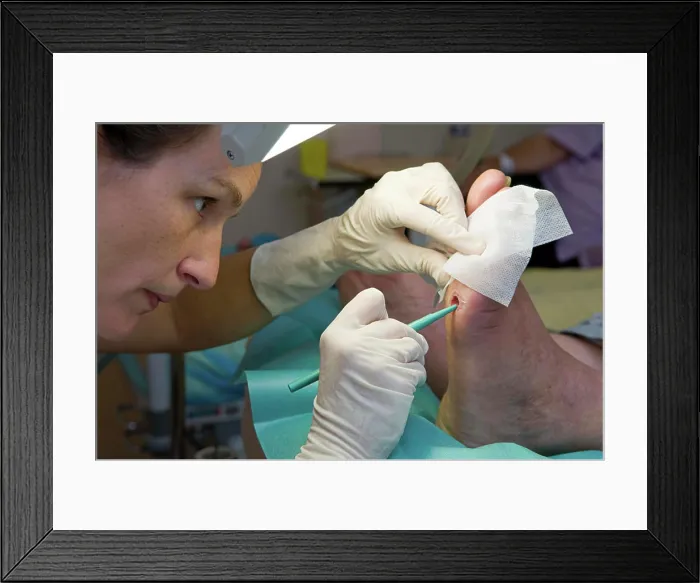 Framed Print : Photo essay in the department of diabetology at Saint-Louis hospital Framed Print : Photo essay in the department of diabetology at Saint-Louis hospital