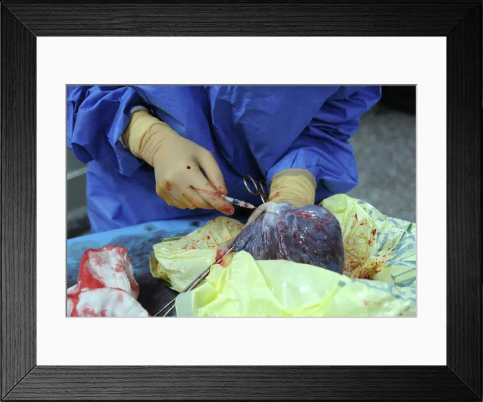 Framed Print : Report at the maternity hospital of the Abbeville hospital Framed Print : Report at the maternity hospital of the Abbeville hospital
