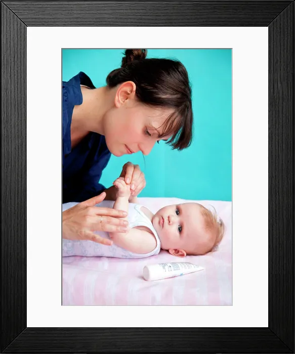 Framed Print : Application of cream on a 5 months old baby Framed Print : Application of cream on a 5 months old baby