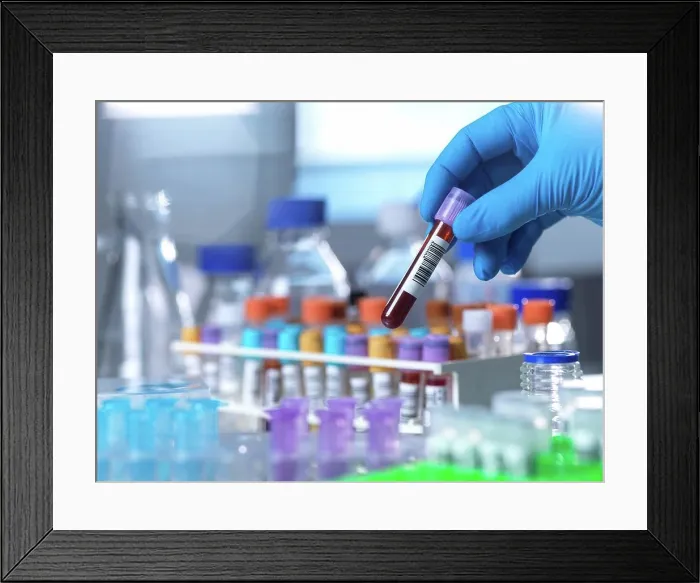Framed Print : Medical testing, conceptual image Framed Print : Medical testing, conceptual image