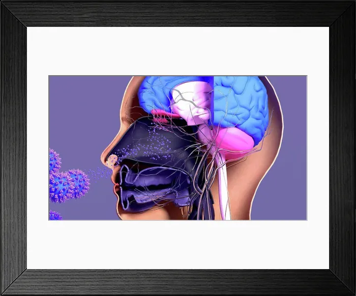 Framed Print : Loss of smell in Covid-19, illustration Framed Print : Loss of smell in Covid-19, illustration