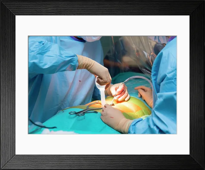 Framed Print : Orthopedic operating theatre, Pasteur 2 Hospital Framed Print : Orthopedic operating theatre, Pasteur 2 Hospital