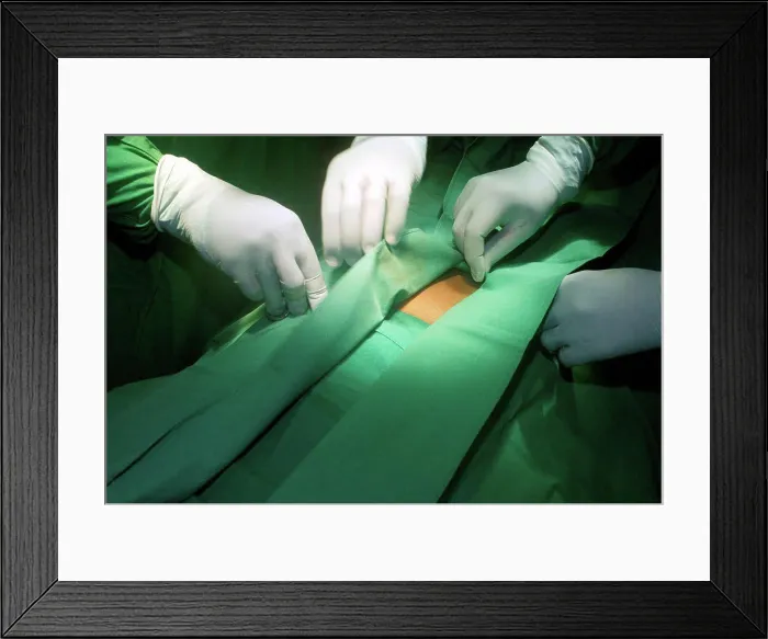 Framed Print : Patient is being prepared for surgical removal of Framed Print : Patient is being prepared for surgical removal of