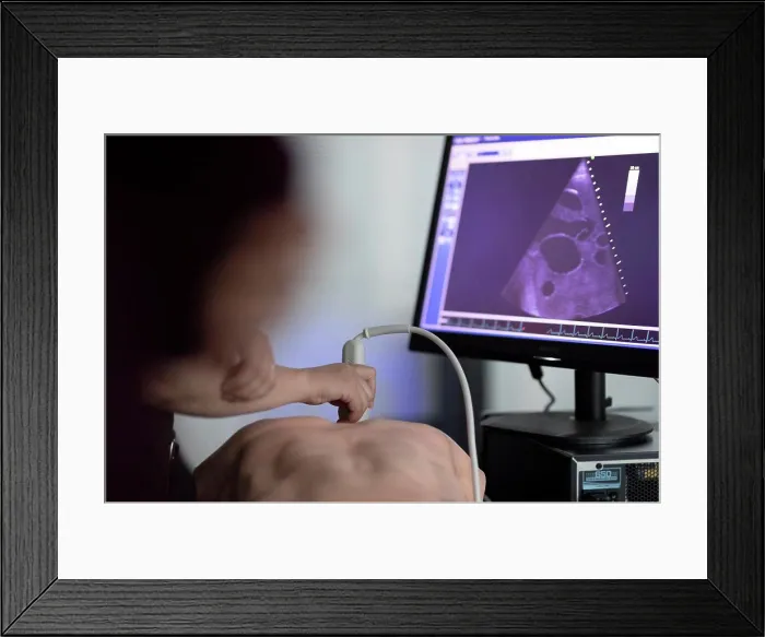 Framed Print : a doctor performs ultrasound on a teaching dummy Framed Print : a doctor performs ultrasound on a teaching dummy