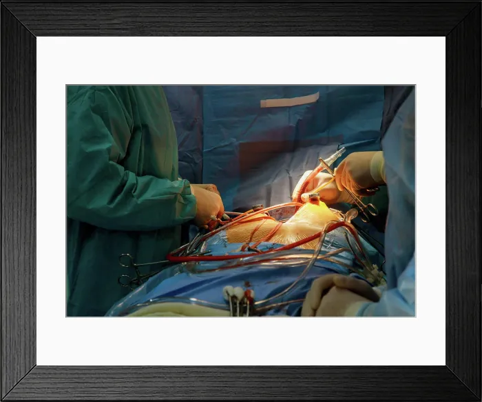 Framed Print : operation, kardiologie, chirurgie Framed Print : operation, kardiologie, chirurgie