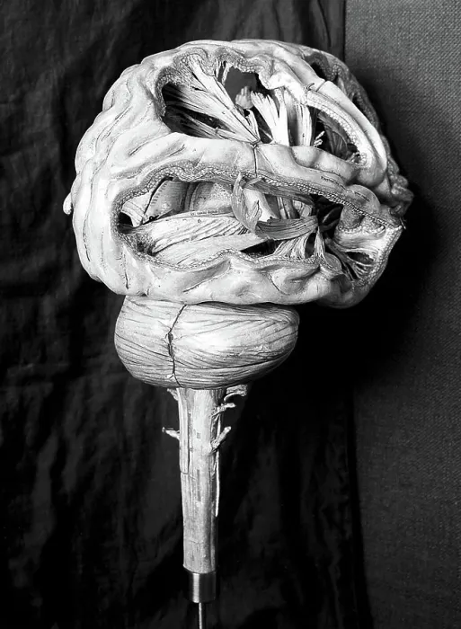 Framed Print : Anatomical model of human brain, paper mache, French, 19th century Framed Print : Anatomical model of human brain, paper mache, French, 19th century