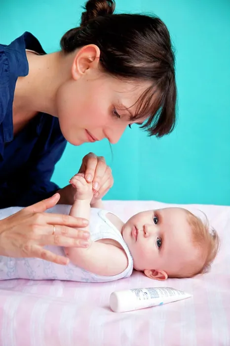 Framed Print : Application of cream on a 5 months old baby Framed Print : Application of cream on a 5 months old baby