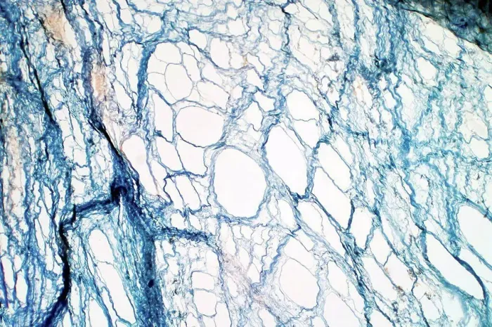 Framed Print : Areolar connective tissue, light micrograph