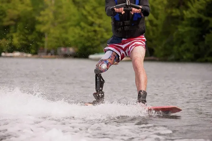 Framed Print : Athlete with an artificial leg water skiing Framed Print : Athlete with an artificial leg water skiing