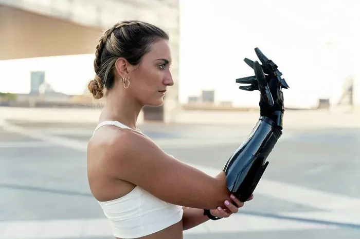 Framed Print : Beautiful young woman looking at arm prosthesis Framed Print : Beautiful young woman looking at arm prosthesis