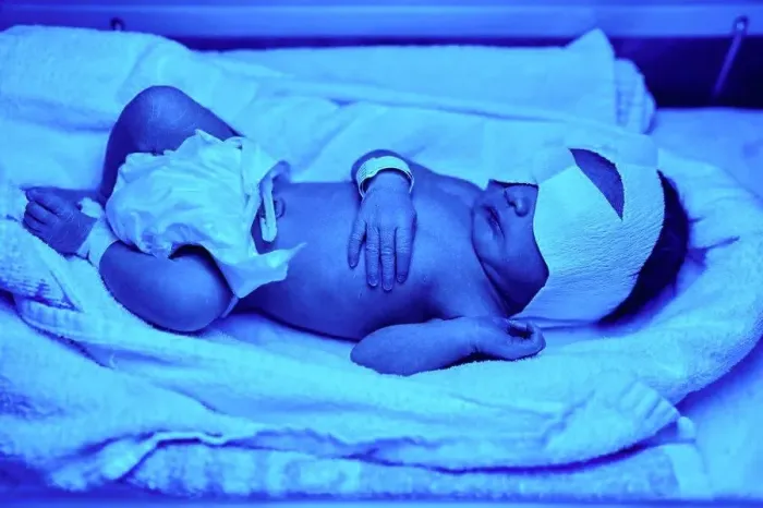 Framed Print : Blue light treatment for baby with jaundice Framed Print : Blue light treatment for baby with jaundice