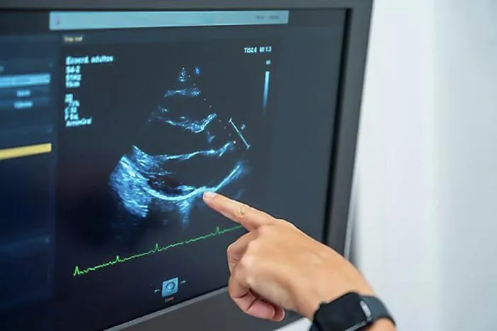 Framed Print : Cardiology clinic with a new ultrasound machine for echocardiogram exams to clients Framed Print : Cardiology clinic with a new ultrasound machine for echocardiogram exams to clients