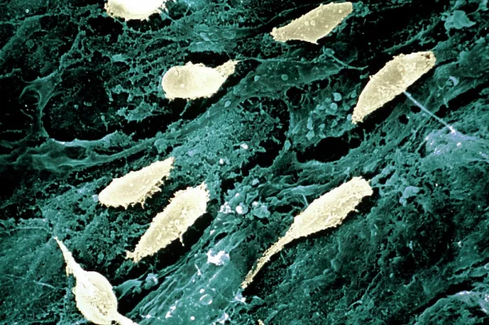 Framed Print : Collagen. Fibroplasts on external surface of intestine ESM (Electron Scanning Microscope)