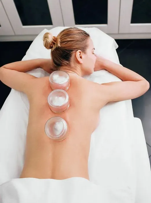 Framed Print : Cupping therapy