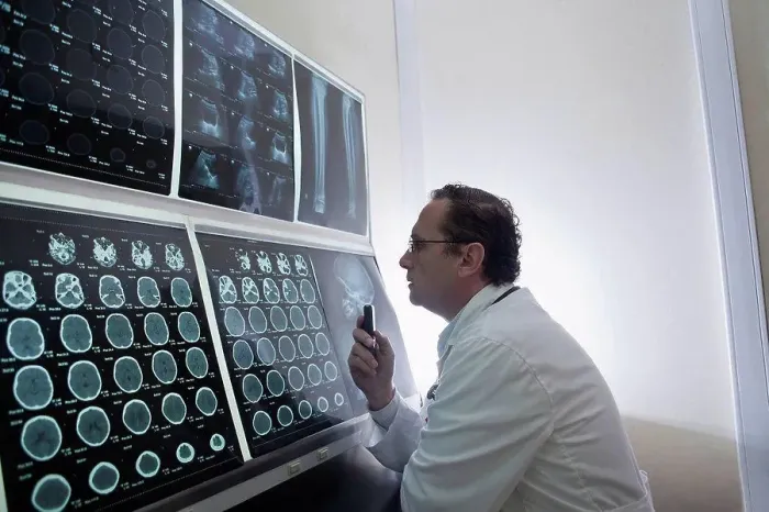 Framed Print : Doctor staring at scans of the brain on lightbox Framed Print : Doctor staring at scans of the brain on lightbox