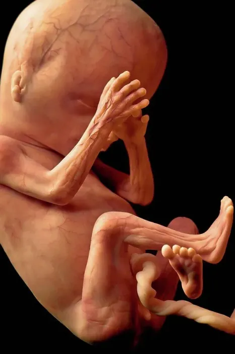 Framed Print : Human Fetal Development at Twenty Weeks fetus Framed Print : Human Fetal Development at Twenty Weeks fetus