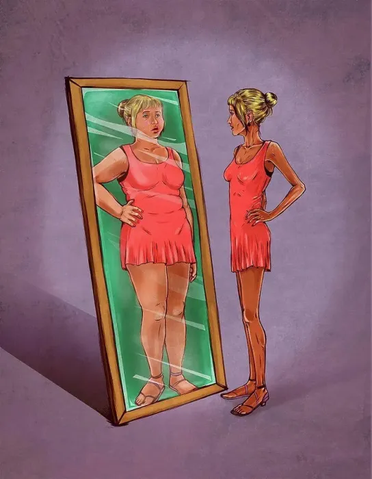 Framed Print : Illustration of eating disorder Framed Print : Illustration of eating disorder