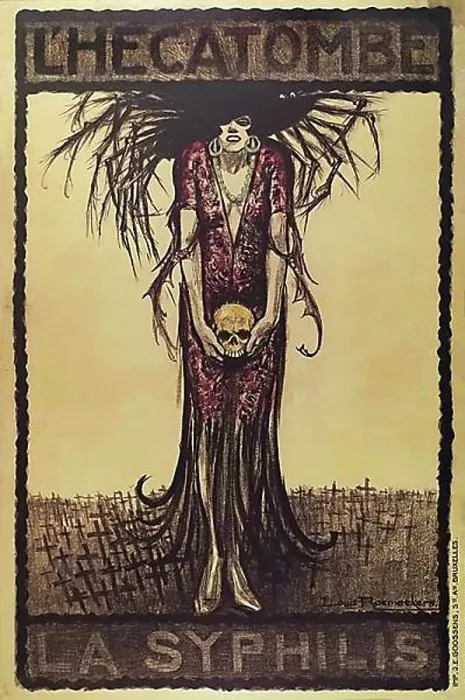Framed Print : La syphilis L'Hecatombe Framed Print : La syphilis L'Hecatombe