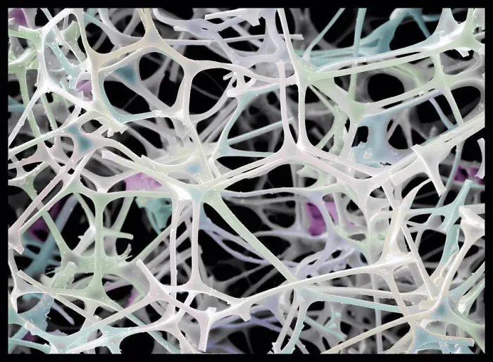Framed Print : Micro-structure of Magic Eraser material, SEM