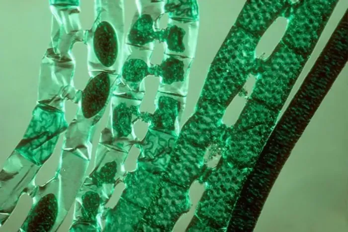Framed Print : Microscopic View of Algae Plant Cells