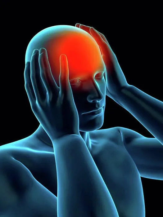 Framed Print : Person with headache, illustration