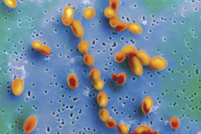 Framed Print : Pneumococcus bacteria (Pneumonia Cells) Framed Print : Pneumococcus bacteria (Pneumonia Cells)
