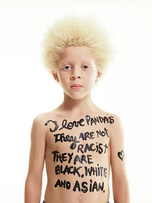Framed Print : Portrait of Albino boy with words painted on body I love pandas, They are not racist, they are black, white and Asian Framed Print : Portrait of Albino boy with words painted on body I love pandas, They are not racist, they are black, white and Asian