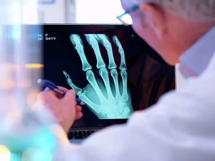 Framed Print : Radiographer looking at x-ray of hand fracture Framed Print : Radiographer looking at x-ray of hand fracture
