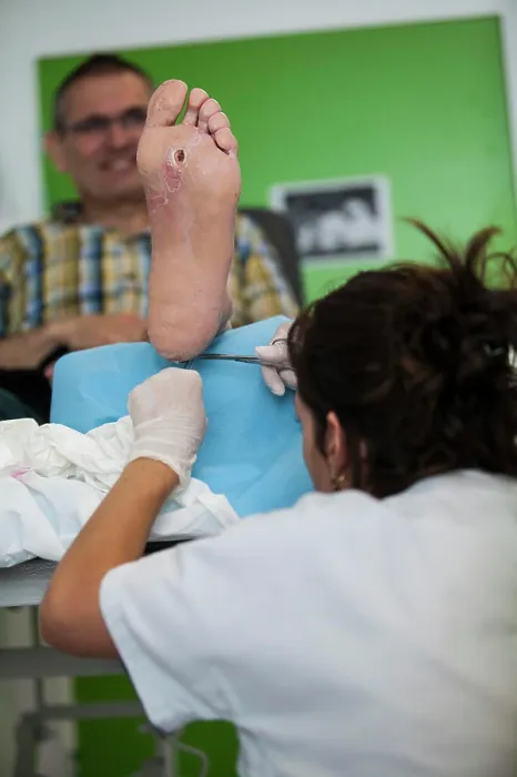 Framed Print : Reportage on diabetic feet consultations in a hospital in Savoie Framed Print : Reportage on diabetic feet consultations in a hospital in Savoie