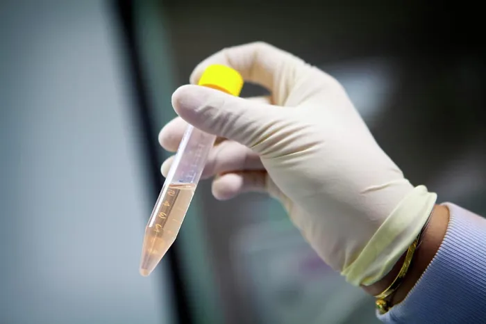 Framed Print : Reportage in a laboratory which develops therapeutic vaccinations to treat small-cell lung cancer Framed Print : Reportage in a laboratory which develops therapeutic vaccinations to treat small-cell lung cancer