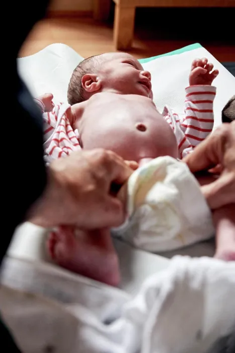 Framed Print : Reportage on a midwife in Lyon, France. Examining a 2-week old babys hips and pelvis Framed Print : Reportage on a midwife in Lyon, France. Examining a 2-week old babys hips and pelvis