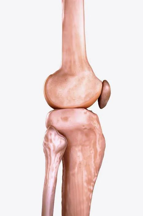 Framed Print : Right Knee Bones Framed Print : Right Knee Bones