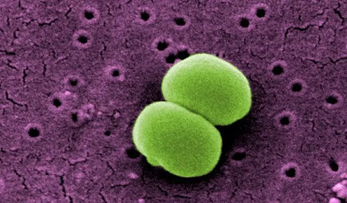 Framed Print : Scanning electron microscopic image of Staphylococcus epidermidis Framed Print : Scanning electron microscopic image of Staphylococcus epidermidis