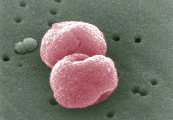 Framed Print : SEM image of Gram-positive Streptococcus pneumoniae bacteria