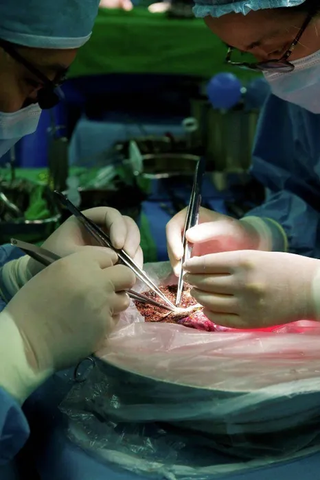 Framed Print : South Korea, Seoul, Samsung Medical Center, surgeons performing liver transplant