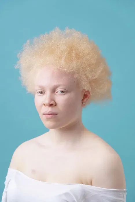 Framed Print : Studio portrait of albino woman Framed Print : Studio portrait of albino woman