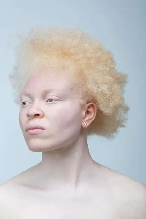 Framed Print : Studio portrait of albino woman Framed Print : Studio portrait of albino woman