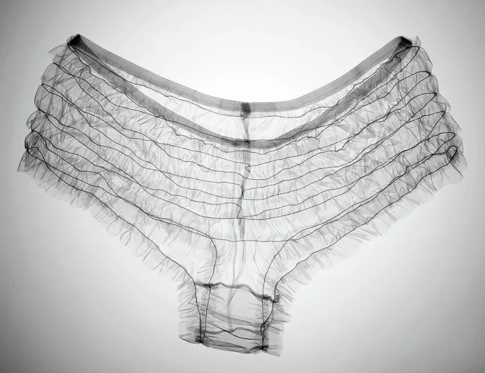 Framed Print : Underwear, X-ray