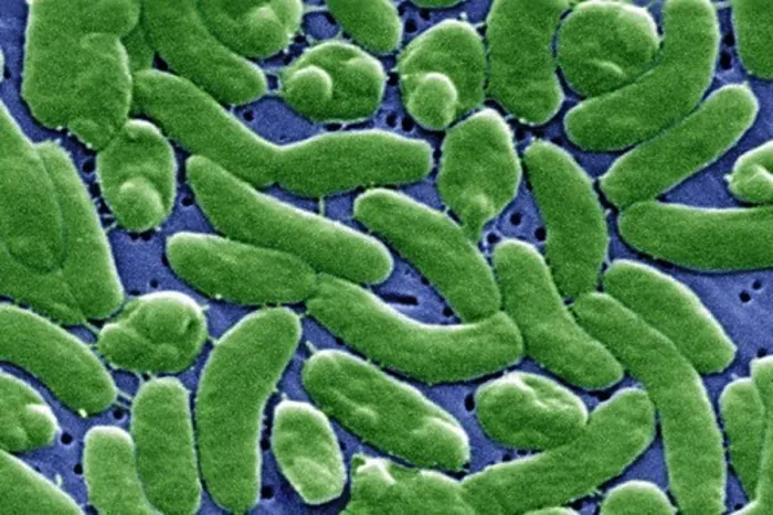 Framed Print : Vibrio vulnificus Bacteria Framed Print : Vibrio vulnificus Bacteria
