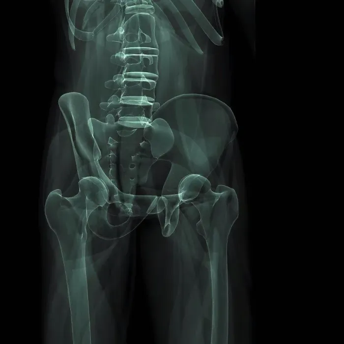 Framed Print : X-Ray image showing the pelvic region Framed Print : X-Ray image showing the pelvic region