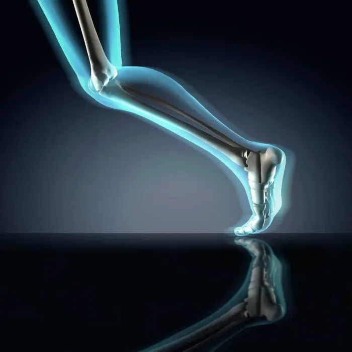 Framed Print : X-ray view of a human's leg in running position