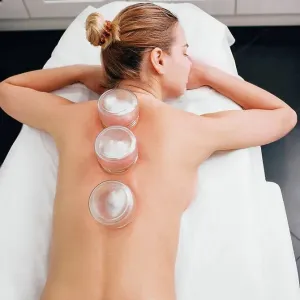 Cupping therapy Cupping therapy