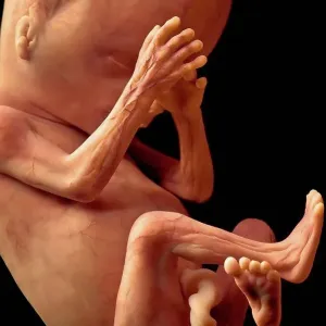 Human Fetal Development at Twenty Weeks fetus Human Fetal Development at Twenty Weeks fetus