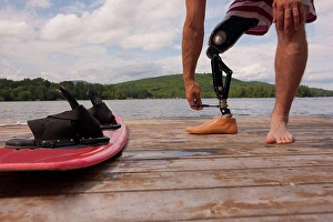 Adaptive Prints: Athlete adjusting his artificial leg on a dock