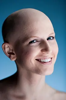 Front Views Prints: Bald woman