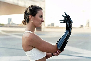 Handicapped Prints: Beautiful young woman looking at arm prosthesis