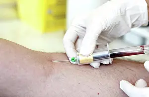 Diagnosis Prints: A blood test is a laboratory analysis performed on a blood sample that is usually extracted from a vein in the arm