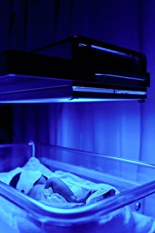 Orient Prints: Blue light treatment for baby with jaundice