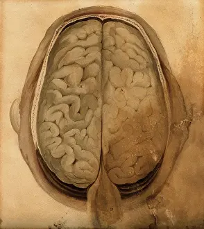Lizars Prints: Brain: dissection showing the gyri