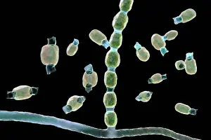 Three Dimensional Prints: Coccidioidomycosis fungus, illustration